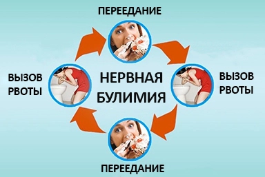 Лечение булимии в Москаленках